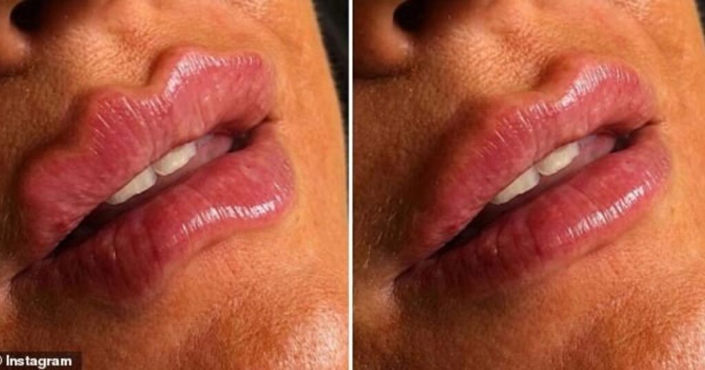 Wavy-Lips-Are-The-Latest-Beauty-Trend-Taking-Over-Social-Media-1024x538