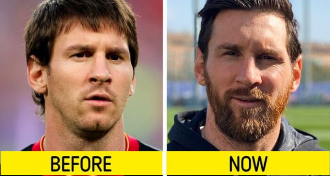 13-Celebrities-Who-Completely-Changed-Their-Look6