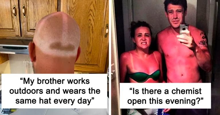 painful-funny-sunburn-fails